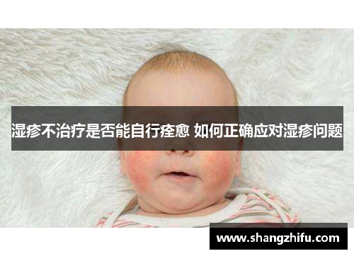 湿疹不治疗是否能自行痊愈 如何正确应对湿疹问题